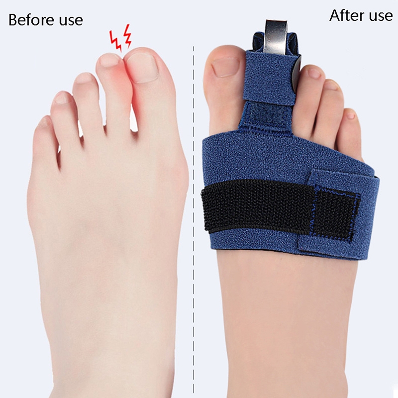 1 ชิ้น อุปกรณ์ปรับนิ้วเท้า แก้ - Ankle Brace Sock บทวิจารณ์และราคา